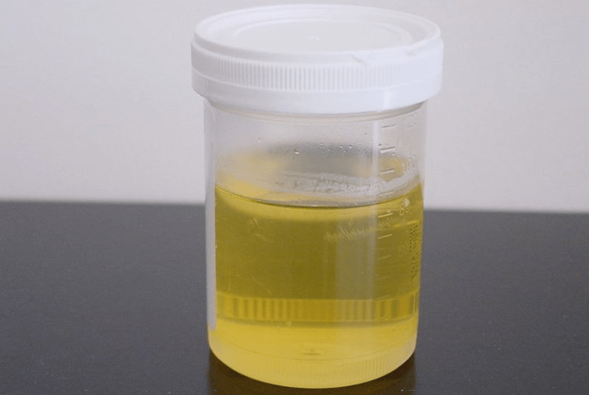 Foamy Urine: What's Normal and What's Not